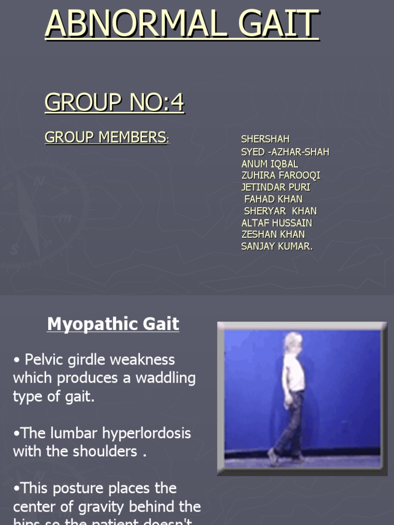 Trendelenburg Gait - Symptoms, Treatment, Exercise - Samarpan, image size:768x1024