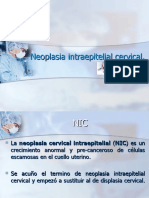 Neoplasia Intraepitelial Cervical