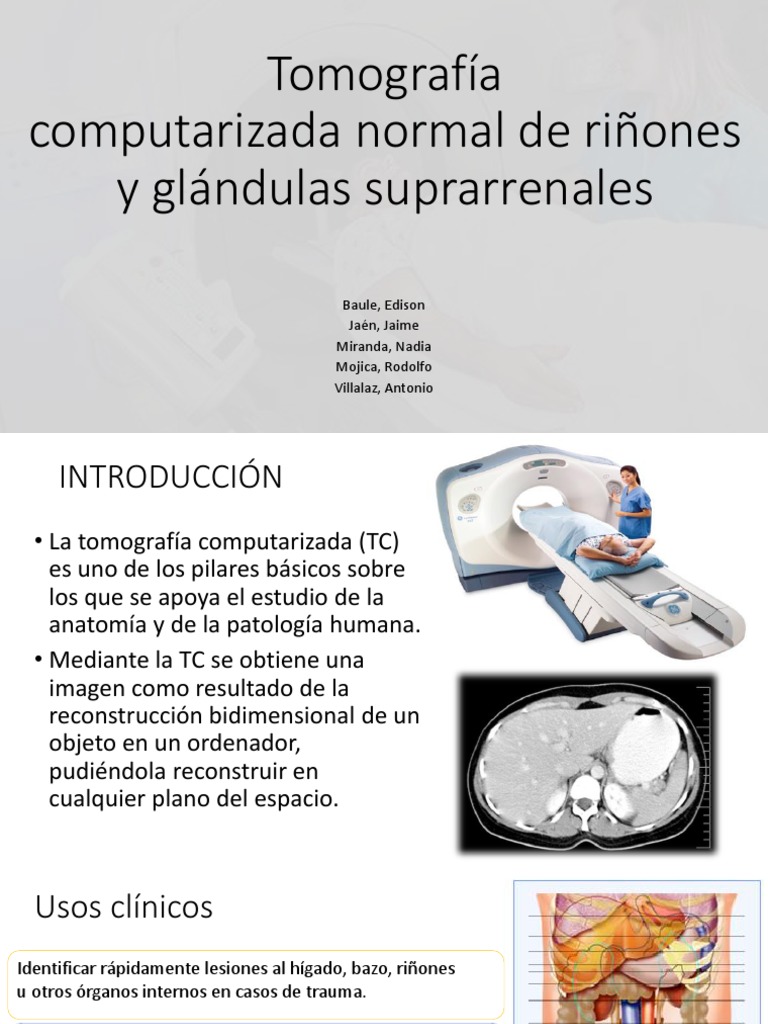 TC Normal de Riñones y Glándulas Suprarrenales | PDF | Peritoneo | Riñón
