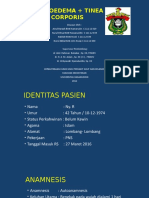 Poster Mini Angioedema+ Tinea Corporis