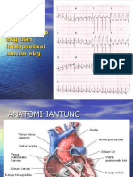 Presentasi Ekg