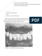 Stomatitis Kontak Alergika Dalam Bahasa Awam