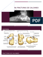 Abordajes PARA FRACTURAS DE CALCANEO