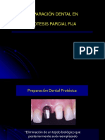 Preparacindental 130115183206 Phpapp02