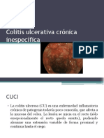 Colitis Ulcerativa Crónica Inespecífica