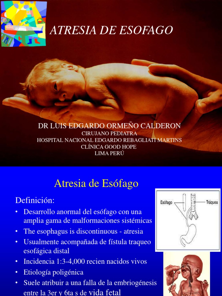 3. Atresia de Esofago Sistema digestivo