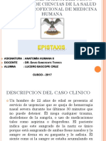 CASO-CLINICO-EPISTAXIS-POSTERIOR.pptx