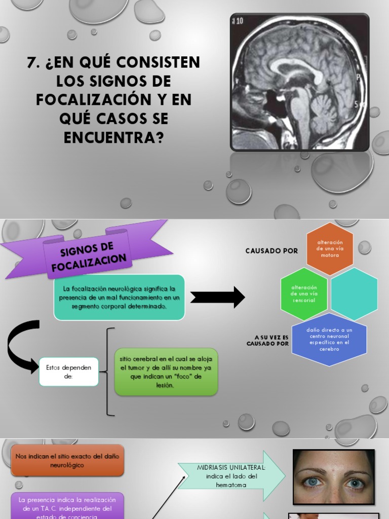 ¿En Qué Consisten Los Signos de Focalización Y en Qué Casos Se — free download