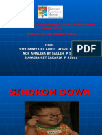 Sindrom Down