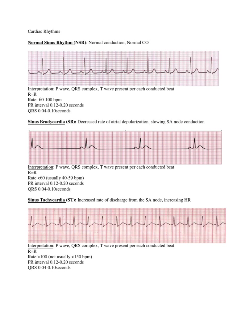 Cardiac Rhythms (3) Electrophysiology Cardiac Arrhythmia