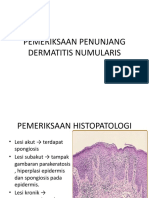 Pemeriksaan Penunjang Dermatitis Numularis