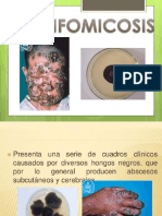 Feohifomicosis.pptx