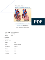 Asuhan Keperawatan Lengkap CHF