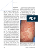 Penfigoide Anti p200 Similar A EBA PDF