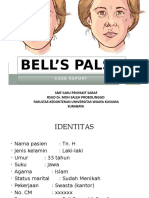 Bells Palsy