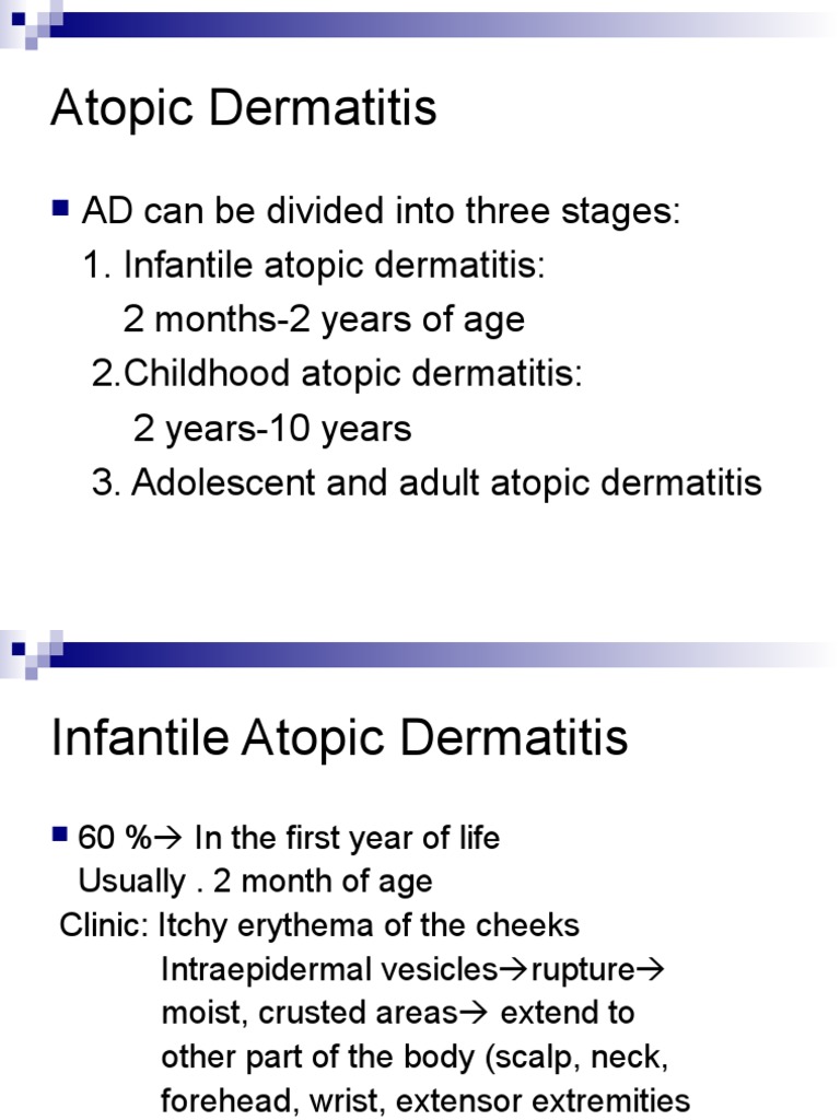Stages and Treatment of Atopic Dermatitis | PDF