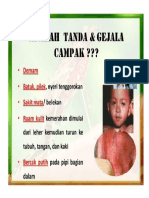 Tanda Gejala Campak