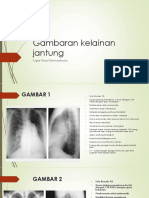 Gambaran Kelainan Jantung