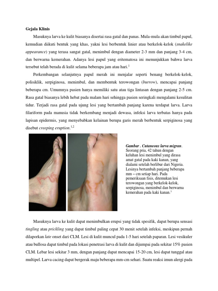 Creeping Eruption PDF