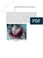 Transvaginal Sonography and The Diagnosis of Adenomyosis: Col (DR) Hanifullah Khan