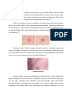 MANIFESTASI KLINIS PSORIASIS