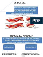 Anemia Falciforme