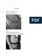 MRI Classification