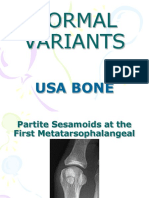 Normal Variants Usa Bone