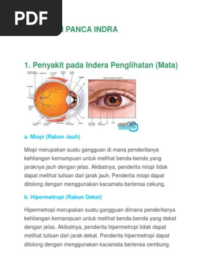 Gangguan Mata Yang Ditolong Dengan Kacamata Cembung Adalah Studi Indonesia