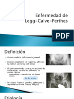 Enfermedad de Legg Calve Perthes