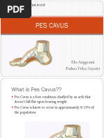 Total Hip Replacement Physiotherapy Guide | PDF