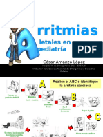 Arritmias Letales en Pediatria (PPTminimizer)