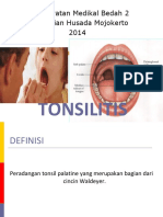 Tonsilitis