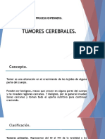 Tumores Cerebrales