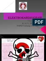 EKG