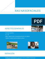 FX Nasofaciales