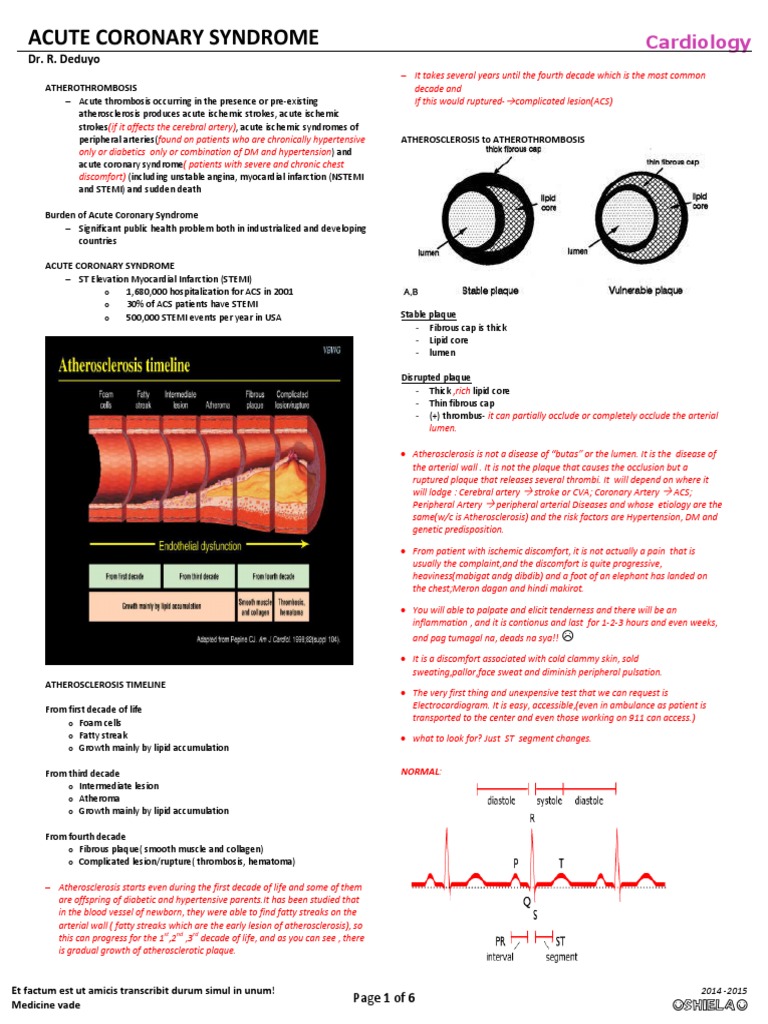 Understanding Acute Coronary Syndrome | PDF | Myocardial Infarction ...