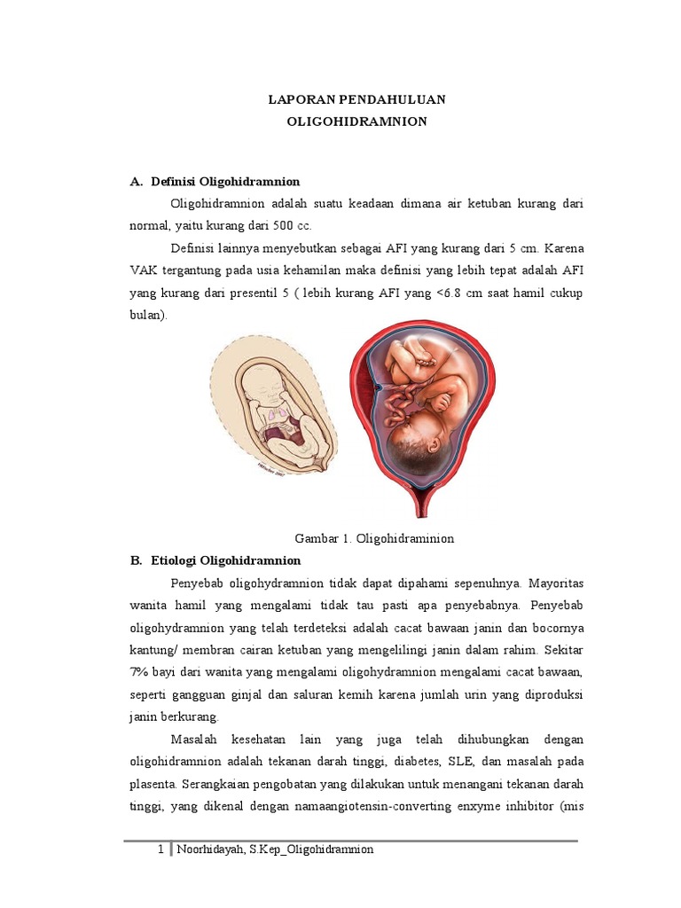 DEFINISI OLIGOHIDRAMNION PDF