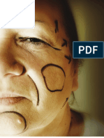 Autologous Fat Grafting Facial Enhancement