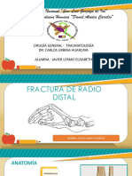 Fractura de Radio Distal