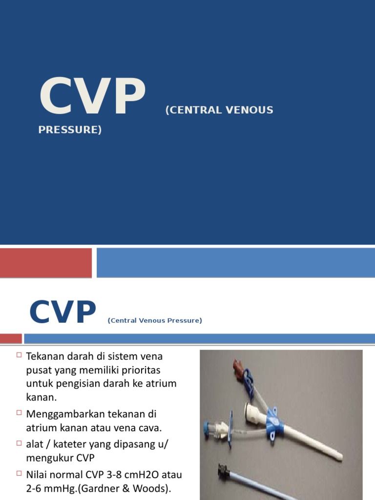 CVP New | PDF