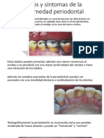 Signos y Síntomas de La Enfermedad Periodontal