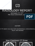 Radiology Report: September 29, 2017 PGI John Christopher Luces