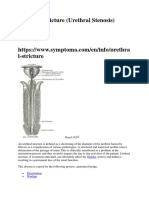 Urethral Stricture Referensi