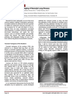 Neonatus Lung Disease