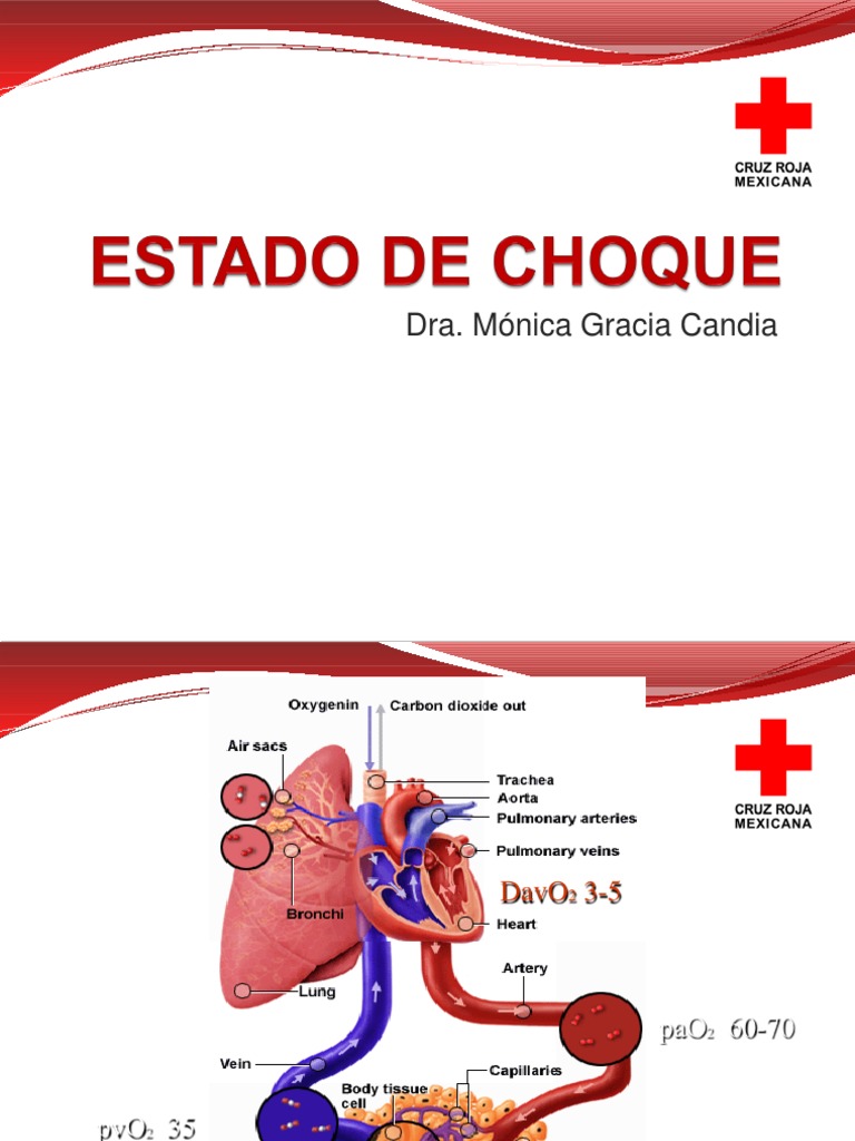 Estado Choque Choque (circulatorio) Septicemia