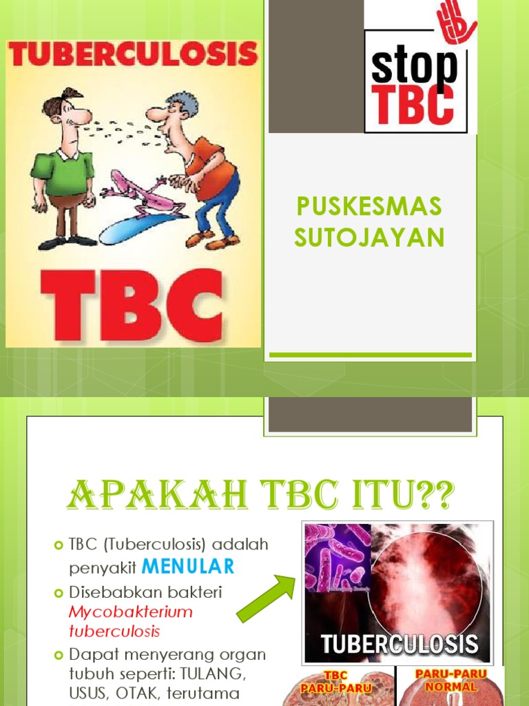 Tbc