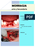 HEMORRAGIA