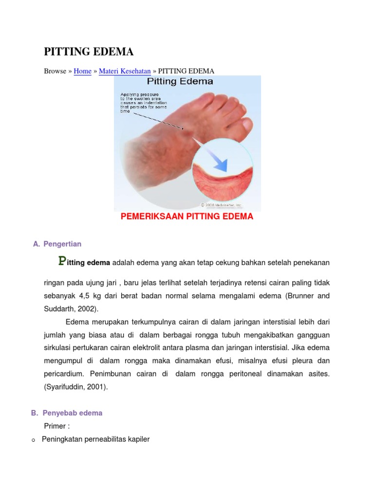 Pitting Edema