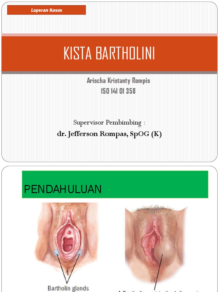 Sharon Stounning mushuki